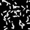 Pseudomonas
			  aeruginosa bacteria