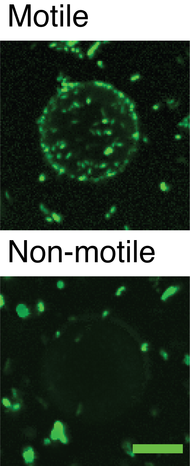 motile and nonmotile bacteria on oil droplets